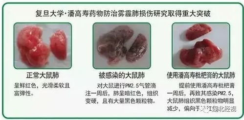 润肺食物全解析，守护呼吸健康的天然选择